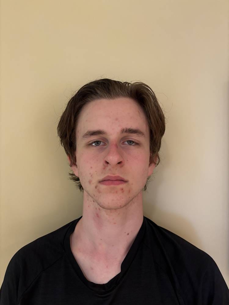 Rhys FRASER